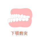 歯並びの例