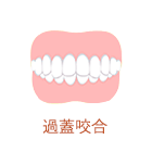 歯並びの例